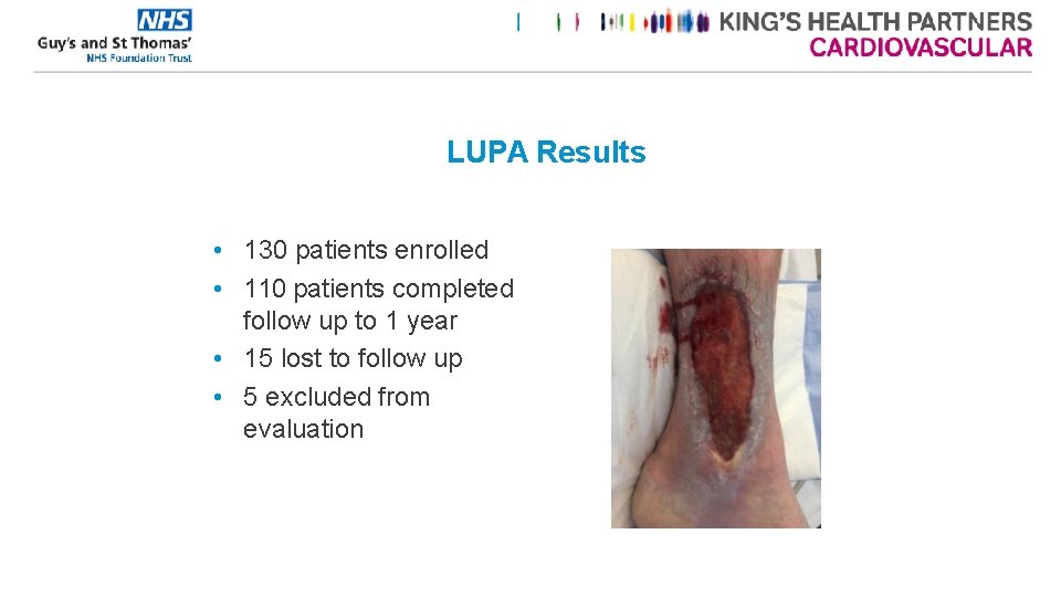 LUPA Results • 130 patients enrolled • 110 patients completed follow up to 1