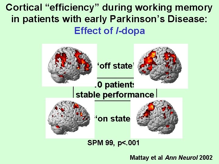 Cortical “efficiency” during working memory in patients with early Parkinson’s Disease: Effect of l-dopa