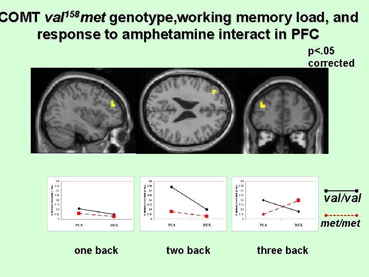 COMT val 158 met genotype, working memory load, and response to amphetamine interact in