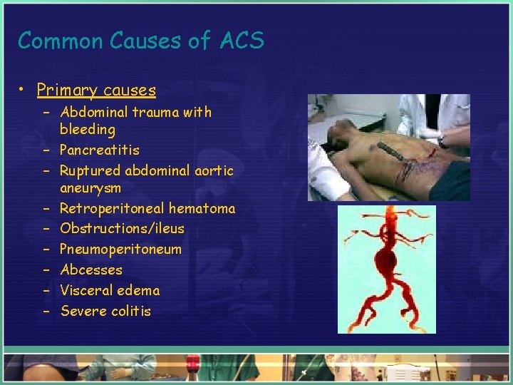 Common Causes of ACS • Primary causes – Abdominal trauma with bleeding – Pancreatitis