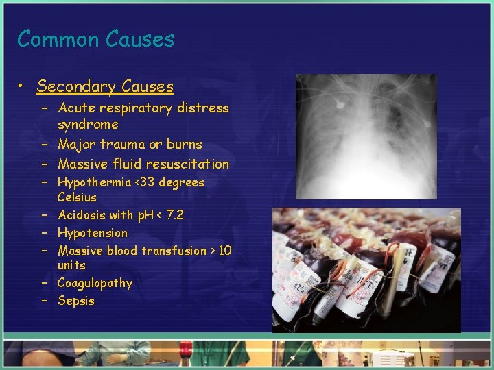 Common Causes • Secondary Causes – Acute respiratory distress syndrome – Major trauma or