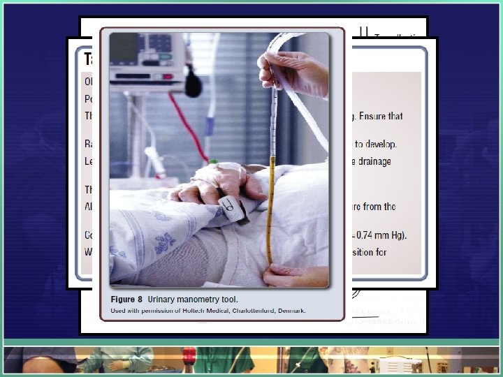 Monometer or U tube technique: 