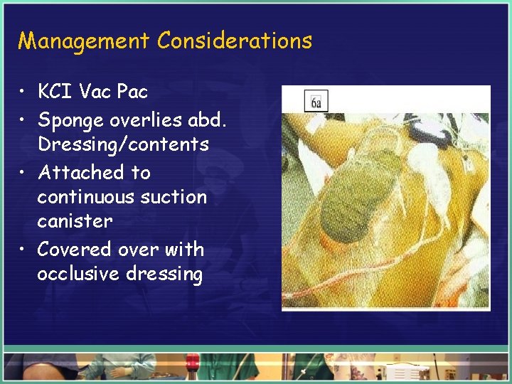 Management Considerations • KCI Vac Pac • Sponge overlies abd. Dressing/contents • Attached to