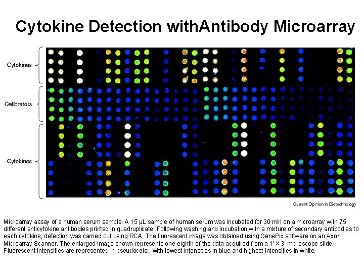 Cytokine Detection with. Antibody Microarray assay of a human serum sample. A 15 µL
