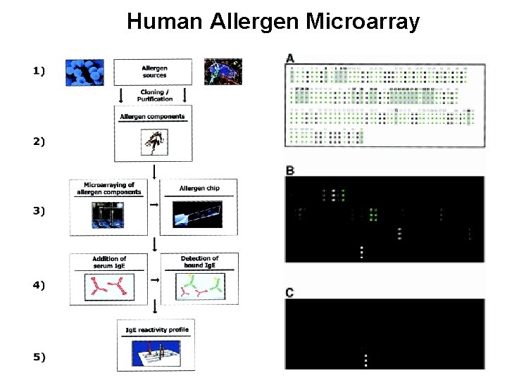 Human Allergen Microarray 