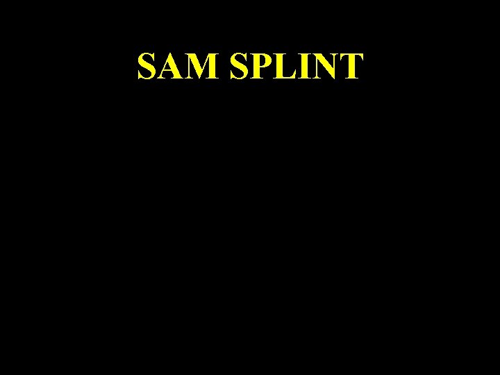 SAM SPLINT 