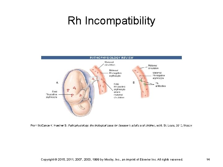 Rh Incompatibility FIG. 8 -13  Development of maternal sensitization to Rh antigens. A, Fetal Rh-positive