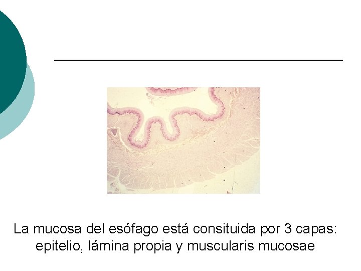 La mucosa del esófago está consituida por 3 capas: epitelio, lámina propia y muscularis