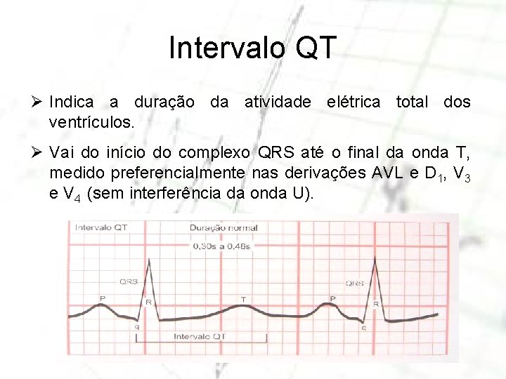 Intervalo QT Ø Indica a duração da atividade elétrica total dos ventrículos. Ø Vai