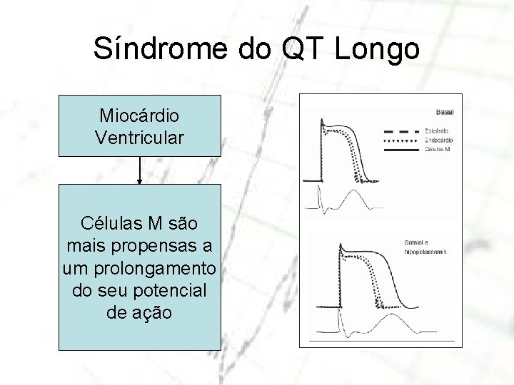 Síndrome do QT Longo Miocárdio Ventricular Células M são mais propensas a um prolongamento