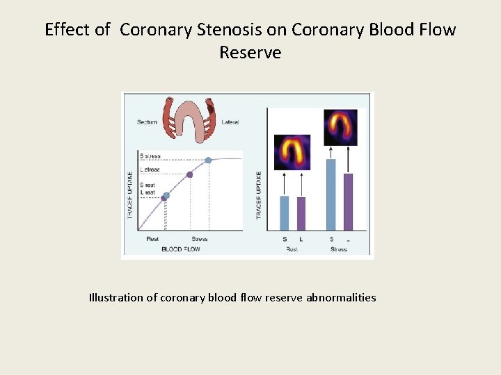 Effect of Coronary Stenosis on Coronary Blood Flow Reserve Illustration of coronary blood flow