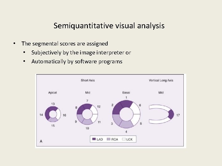 Semiquantitative visual analysis • The segmental scores are assigned • Subjectively by the image