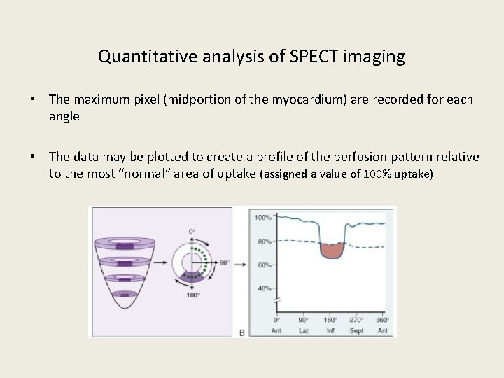 Quantitative analysis of SPECT imaging • The maximum pixel (midportion of the myocardium) are