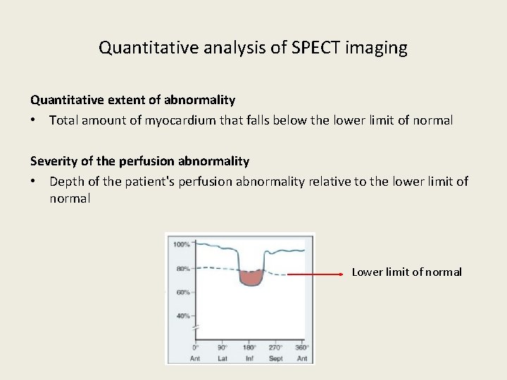 Quantitative analysis of SPECT imaging Quantitative extent of abnormality • Total amount of myocardium