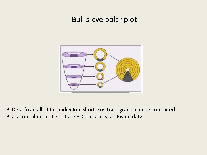  Bull's-eye polar plot • Data from all of the individual short-axis tomograms can