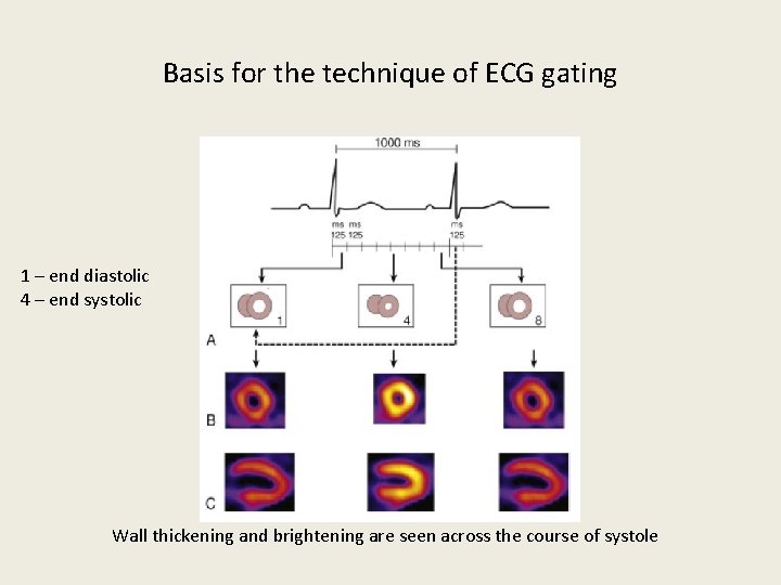 Basis for the technique of ECG gating 1 – end diastolic 4 – end