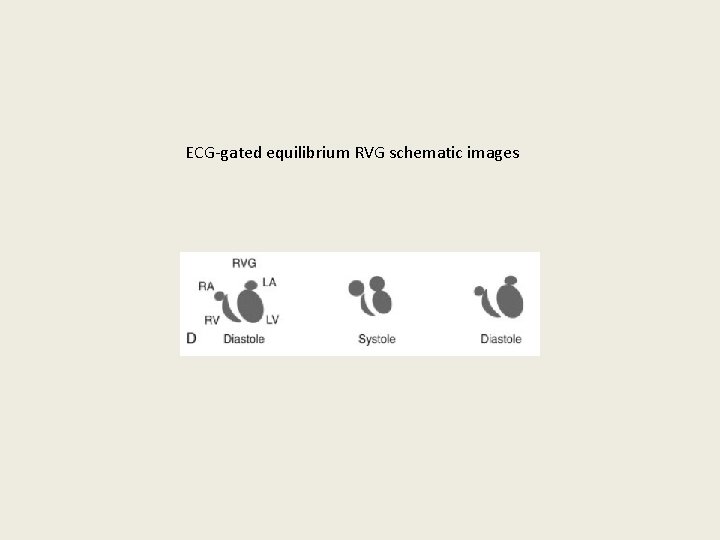 ECG-gated equilibrium RVG schematic images 