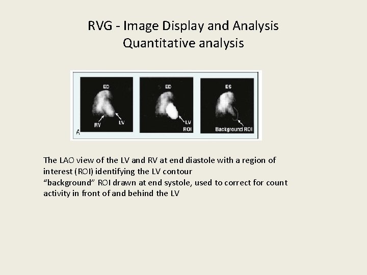 RVG - Image Display and Analysis Quantitative analysis The LAO view of the LV
