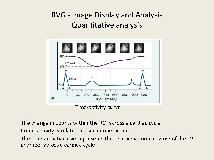 RVG - Image Display and Analysis Quantitative analysis Time-activity curve The change in counts