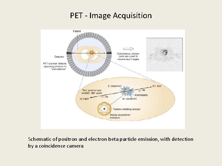 PET - Image Acquisition Schematic of positron and electron beta particle emission, with detection