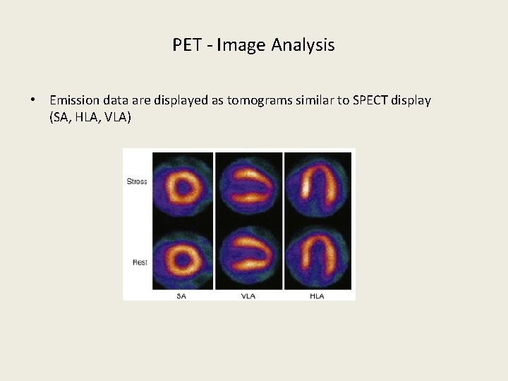 PET - Image Analysis • Emission data are displayed as tomograms similar to SPECT