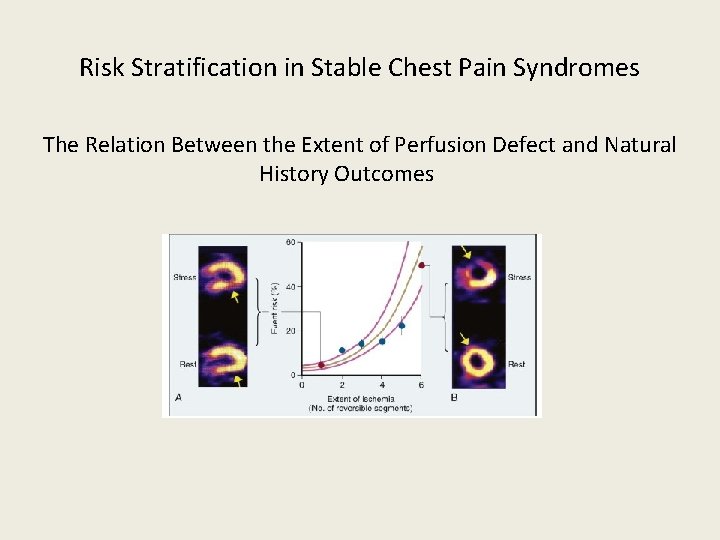 Risk Stratification in Stable Chest Pain Syndromes The Relation Between the Extent of Perfusion