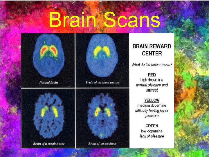 Brain Scans 