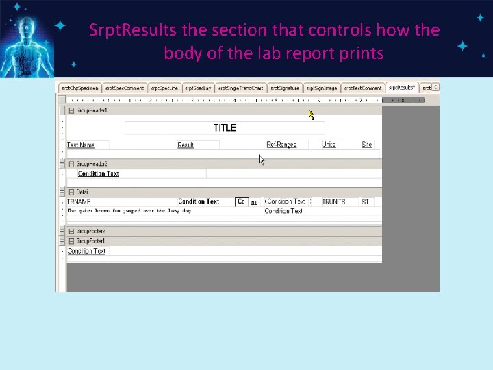 Srpt. Results the section that controls how the body of the lab report prints