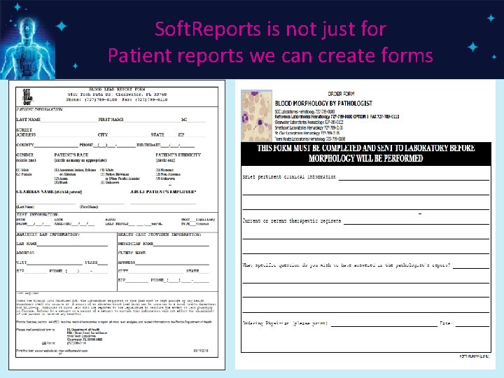 Soft. Reports is not just for Patient reports we can create forms 