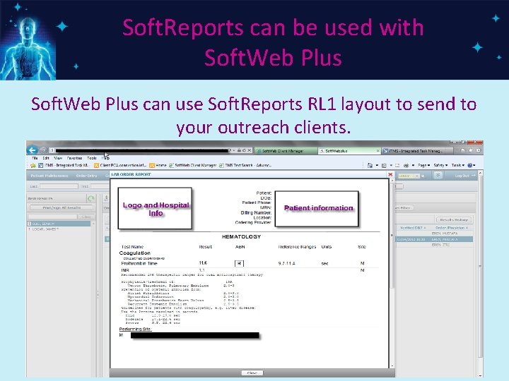 Soft. Reports can be used with Soft. Web Plus can use Soft. Reports RL