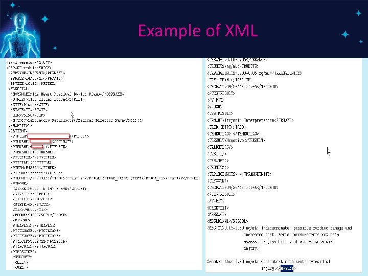 Example of XML 