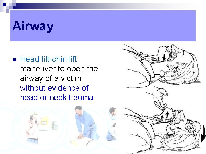 Airway n Head tilt-chin lift maneuver to open the airway of a victim without