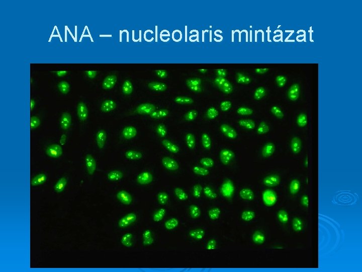 ANA – nucleolaris mintázat 