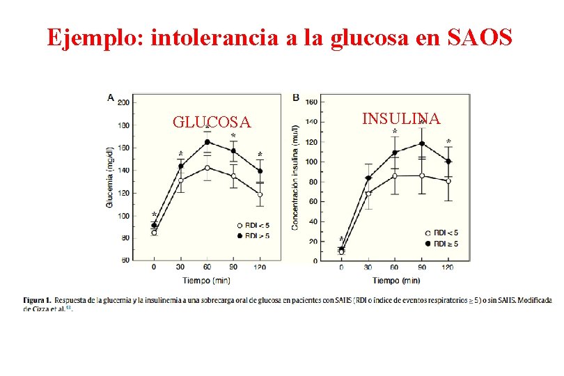 Ejemplo: intolerancia a la glucosa en SAOS GLUCOSA INSULINA 