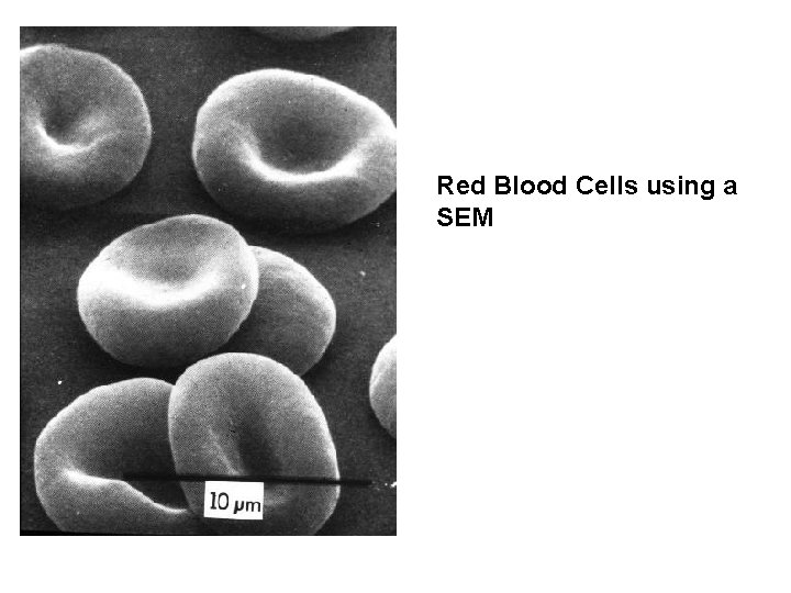 Red Blood Cells using a SEM 