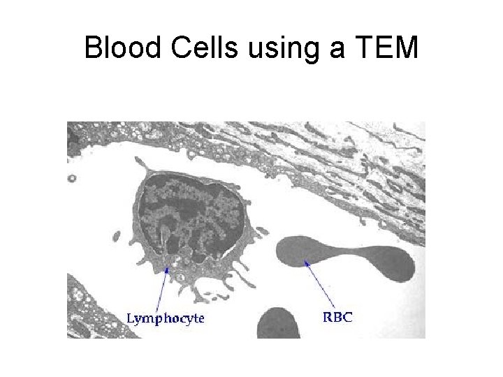 Blood Cells using a TEM 