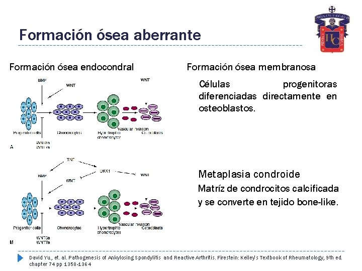 Formación ósea aberrante Formación ósea endocondral Formación ósea membranosa Células progenitoras diferenciadas directamente en