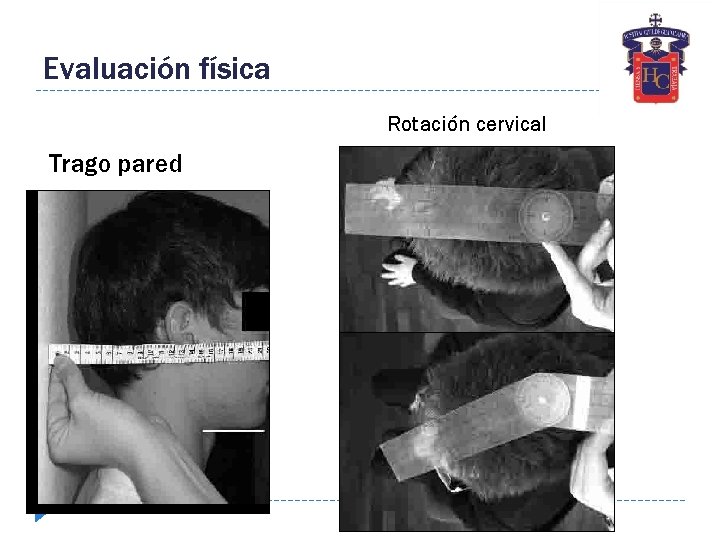 Evaluación física Rotación cervical Trago pared 