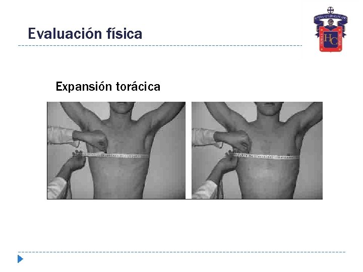 Evaluación física Expansión torácica 