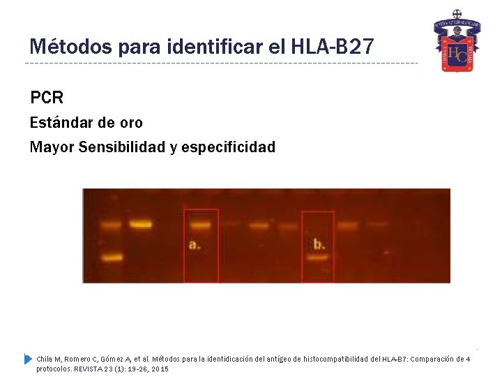 Métodos para identificar el HLA-B 27 PCR Estándar de oro Mayor Sensibilidad y especificidad