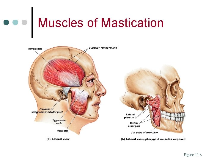 Muscles of Mastication Figure 11– 6 