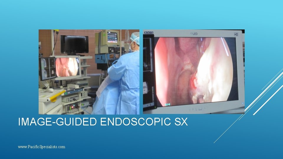 IMAGE-GUIDED ENDOSCOPIC SX www. Pacific. Specialists. com 