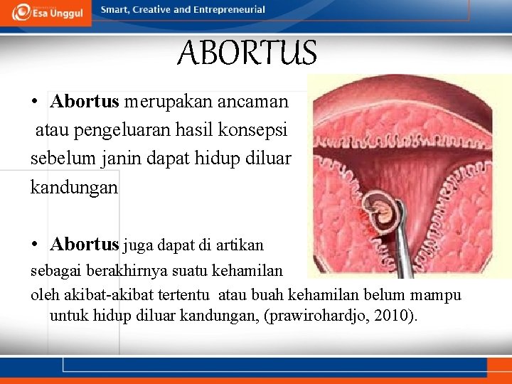 ABORTUS • Abortus merupakan ancaman atau pengeluaran hasil konsepsi sebelum janin dapat hidup diluar