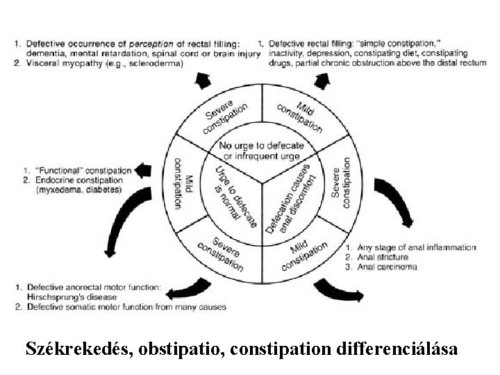 Székrekedés, obstipatio, constipation differenciálása 