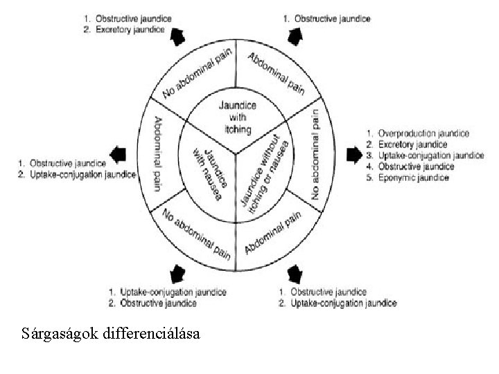 Sárgaságok differenciálása 