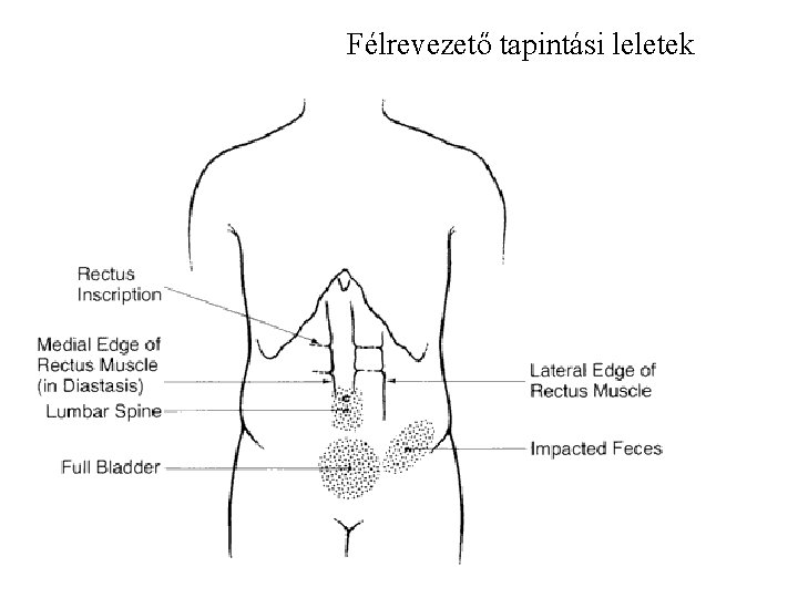 Félrevezető tapintási leletek 