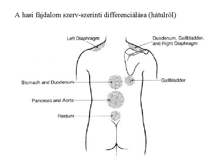 A hasi fájdalom szerv-szerinti differenciálása (hátulről) 