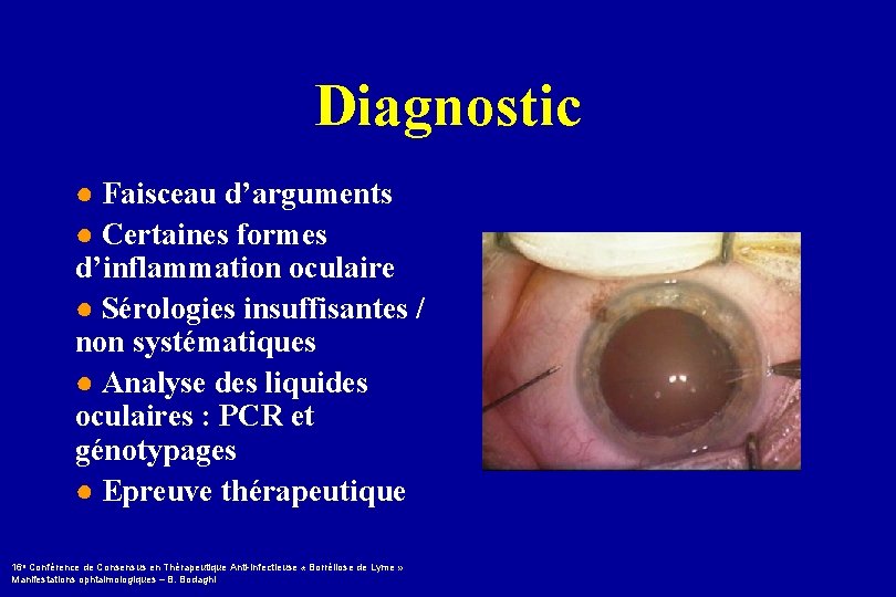 Diagnostic ● Faisceau d’arguments ● Certaines formes d’inflammation oculaire ● Sérologies insuffisantes / non