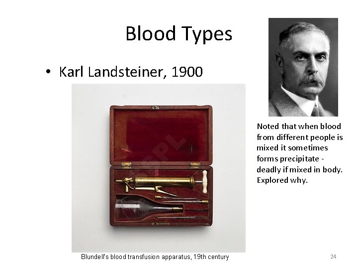 Blood Types • Karl Landsteiner, 1900 Noted that when blood from different people is