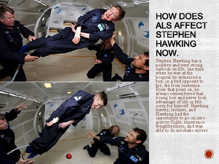 HOW DOES ALS AFFECT STEPHEN HAWKING NOW. Stephen Hawking has a positive and very